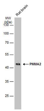 MA2 Antibody in Western Blot (WB)