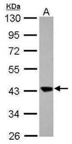 MA2 Antibody in Western Blot (WB)