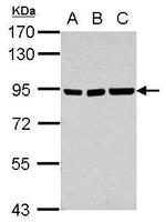 ZNF31 Polyclonal Antibody