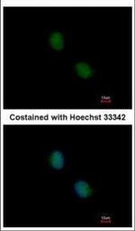 PSMB7 Antibody in Immunocytochemistry (ICC/IF)
