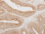 SERPINA12 Polyclonal Antibody