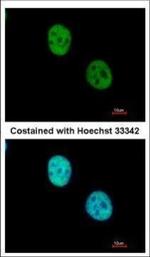 WDR4 Polyclonal Antibody