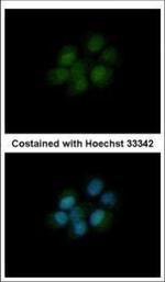 DHFR Polyclonal Antibody