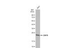 DHFR Antibody in Western Blot (WB)