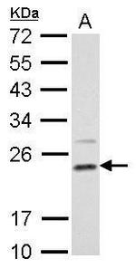 DHFR Antibody in Western Blot (WB)