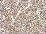 UBE2V2 Polyclonal Antibody