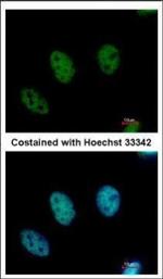 CDYL Polyclonal Antibody