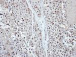 CDYL Antibody in Immunohistochemistry (Paraffin) (IHC (P))
