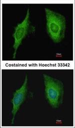 CRIP2 Polyclonal Antibody