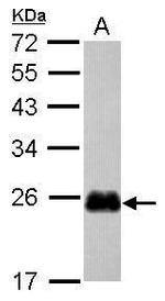 CRIP2 Antibody in Western Blot (WB)