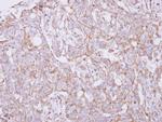 TXNDC9 Polyclonal Antibody