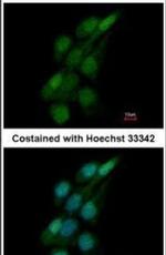 TRIM62 Antibody in Immunocytochemistry (ICC/IF)
