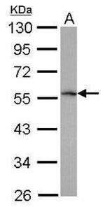 TRIM62 Antibody in Western Blot (WB)
