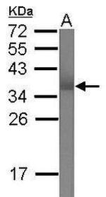 TRIM62 Antibody in Western Blot (WB)