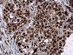 GPKOW Antibody in Immunohistochemistry (Paraffin) (IHC (P))