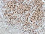 GPKOW Antibody in Immunohistochemistry (Paraffin) (IHC (P))