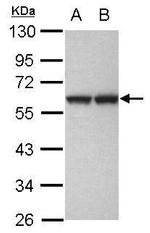 GPKOW Antibody in Western Blot (WB)