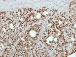 GPKOW Antibody in Immunohistochemistry (Paraffin) (IHC (P))