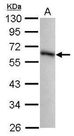 GPKOW Antibody in Western Blot (WB)