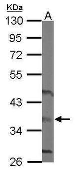 HAPLN3 Antibody in Western Blot (WB)