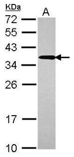 UBC3B Antibody in Western Blot (WB)