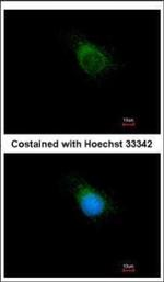 PAT1 Polyclonal Antibody