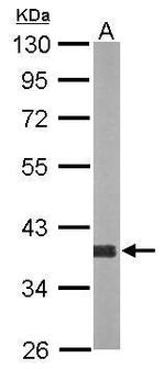 AKR1D1 Polyclonal Antibody