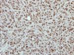 RPP30 Polyclonal Antibody
