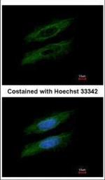 GSDMB Polyclonal Antibody