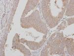 ADAMTSL1 Polyclonal Antibody