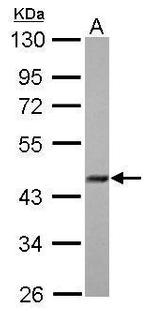 FBXO22 Polyclonal Antibody