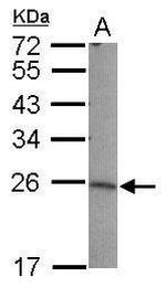 LIN7B Polyclonal Antibody