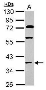 HOXC13 Polyclonal Antibody