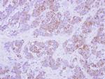 Cytokeratin 2e Polyclonal Antibody