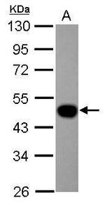 LEFTY Polyclonal Antibody