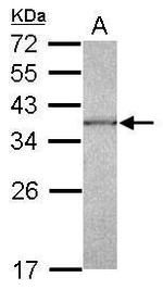 CAPZA1 Antibody in Western Blot (WB)
