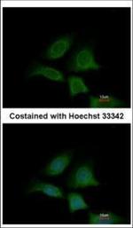 EXOC4 Polyclonal Antibody