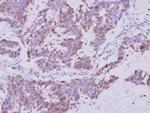 EXOC4 Antibody in Immunohistochemistry (Paraffin) (IHC (P))