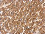 SIRT5 Polyclonal Antibody