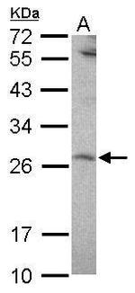 SENP8 Antibody in Western Blot (WB)