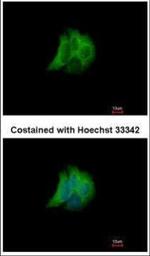 RAB17 Polyclonal Antibody