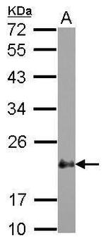 CRP2 Polyclonal Antibody