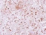 SPRED2 Polyclonal Antibody
