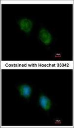 COPS4 Polyclonal Antibody