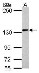 PCDH10 Polyclonal Antibody