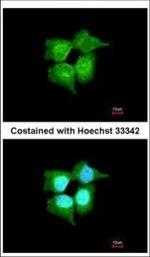 RABL6 Antibody in Immunocytochemistry (ICC/IF)