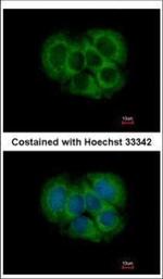FGFR1OP2 Polyclonal Antibody