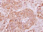 FGFR1OP2 Antibody in Immunohistochemistry (Paraffin) (IHC (P))