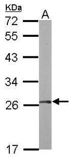 FGFR1OP2 Antibody in Western Blot (WB)