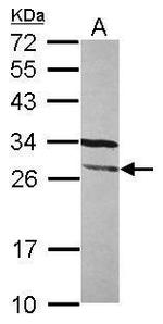 FGFR1OP2 Antibody in Western Blot (WB)
